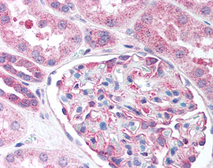 RFP-Human Colorectal Adenocarcinoma Cells (SW480)