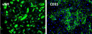Human Umbilical Vein Endothelial Cells (HUVECs)