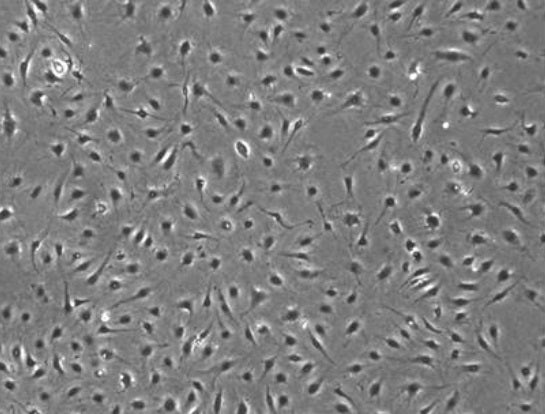 Primary Human Internal Mammary Artery Endothelial Cells (HIMAECs)