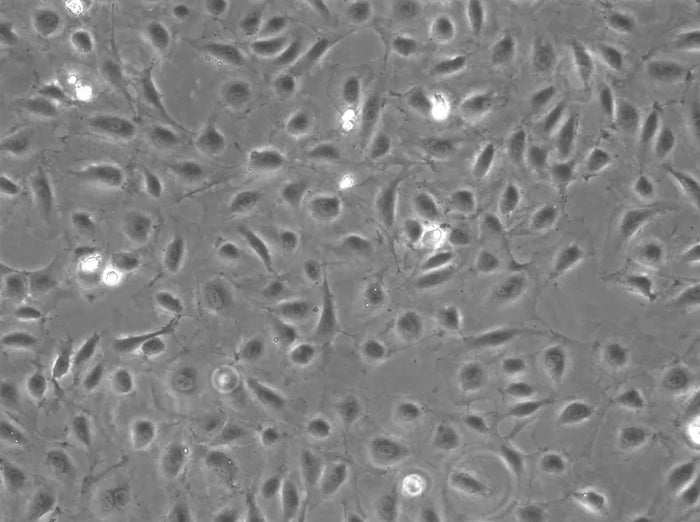 Primary Human Large Intestine Microvascular Endothelial Cells (HLInMVECs)
