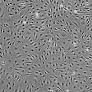 Primary Human Ovarian Microvascular Endothelial Cells (HOMVECs)