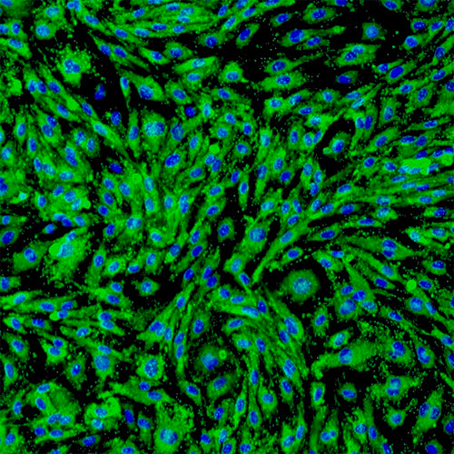 Primary Human Ovarian Microvascular Endothelial Cells (HOMVECs)