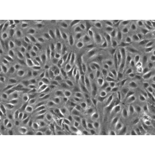 Human Adipose Microvascular Endothelial Cells (HAMVECs)