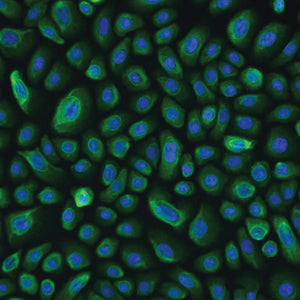Primary Human Small Intestine Microvascular Endothelial Cells (HSIMVECs)