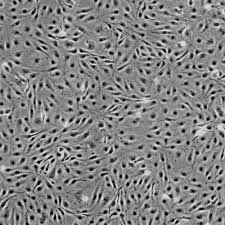 SV40-Human Pulmonary Microvascular Endothelial Cells (SV40-HPuMVECs)
