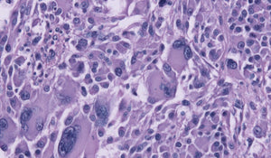 Human A375 Skin Melanoma Cells