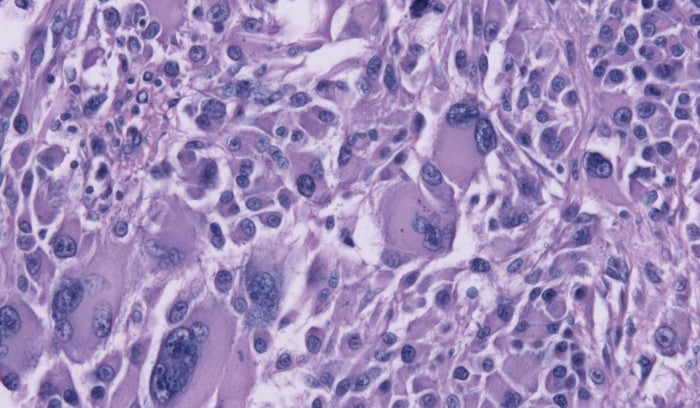 Human Gastric Carcinoma N87 Cells