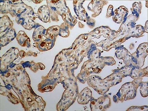 GFP-Human PC3 Prostate Adenocarcinoma Cells