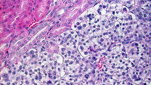 PC3 Prostate Adenocarcinoma Cells