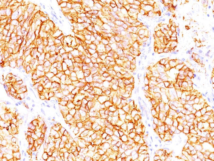 Human Renal Adenocarcinoma Cells (ACHN)