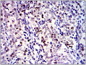 GFP Expressing Human Glioblastoma Cells (GFP-U87MG)