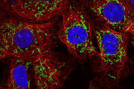 RFP Expressing Human Ovarian Cancer Cells