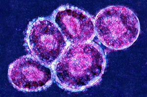 Human Adrenocortical Carcinoma Cells (NCI-H295R)